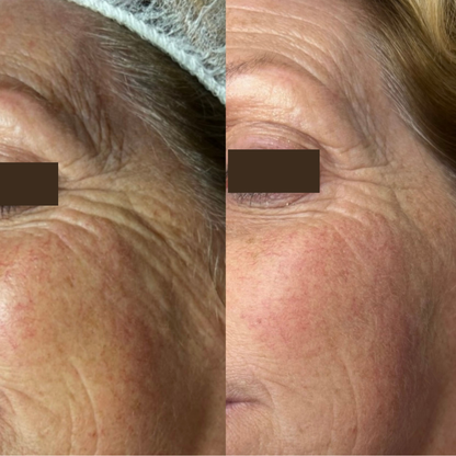 Inner Glow Collagen Cream – Firms your skin. Rebuilds your magnetic radiance.