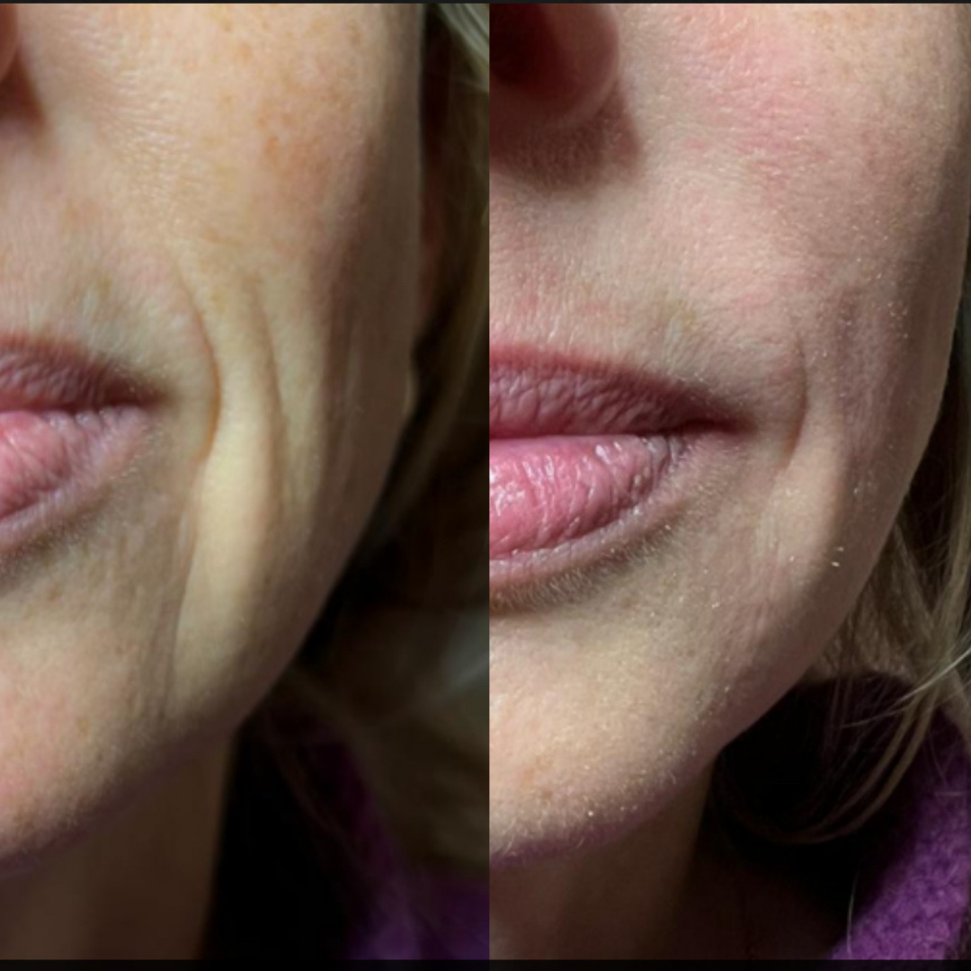 Inner Glow Collagen Cream – Firms your skin. Rebuilds your magnetic radiance.